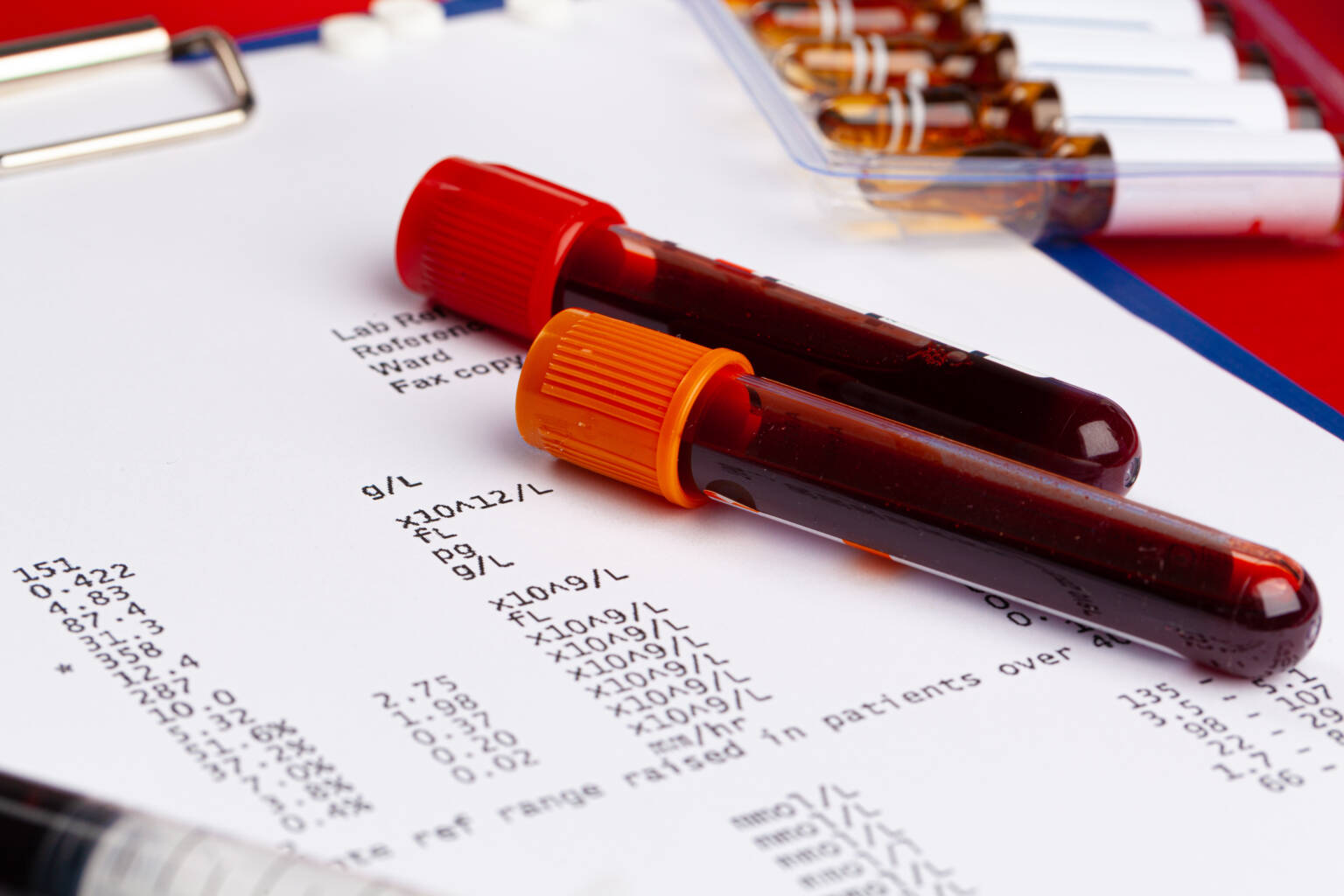 Exames laboratoriais